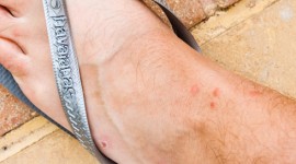 Four Seasons Sharm El Sheikh: Dear Mosquitoes,